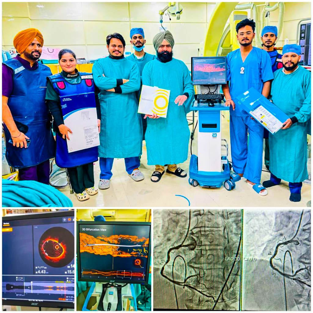 First OCTGuided Rotatripsy Procedure Performed at Park Hospital Patiala
